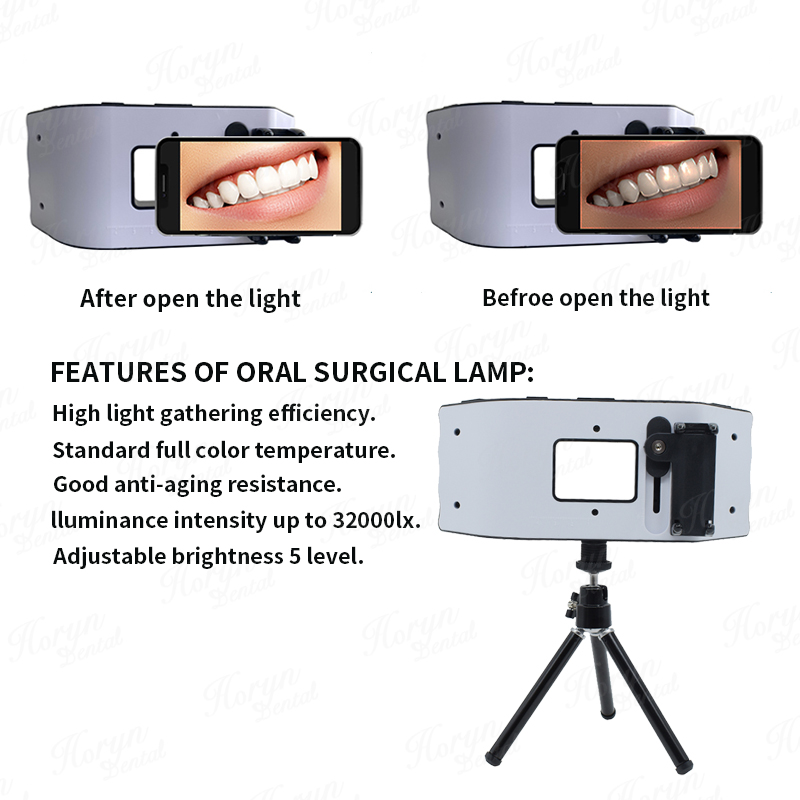Luz de flash dental equipament - Photography Lighting With Flash avaliação e preço
